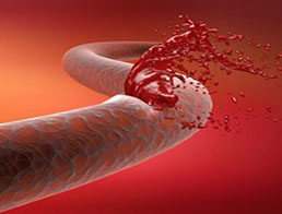 Гемофілія: перспективи лікування за допомогою генної терапії