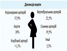 Дисекція артерій у вагітних: визначення факторів ризику