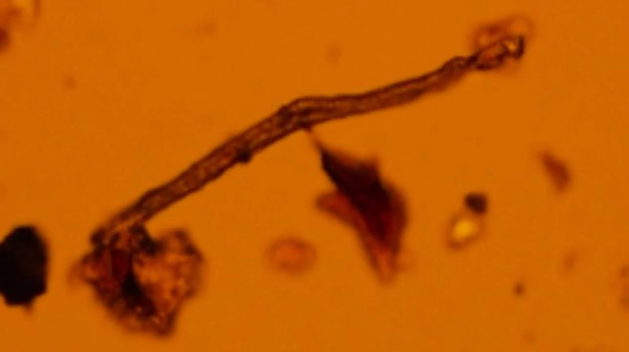 Мікропластик знайдено у 100% досліджених плацент